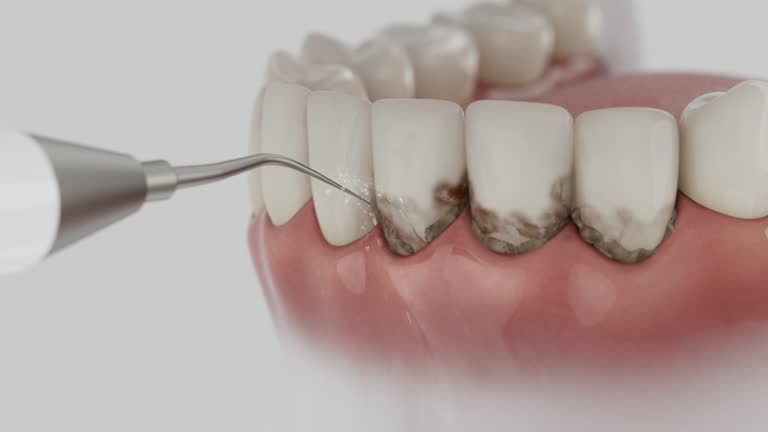 Trusted Root Canal Treatment service in Peabody, KS - Dentist Open Now